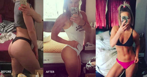 before and after photo showing leg transformation