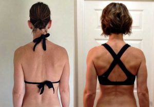 before and after photo showing back view of woman